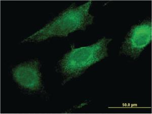 Anti-FAIM2 Mouse Monoclonal Antibody [clone: 2C2]