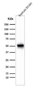 Anti-GFAP Mouse Monoclonal Antibody [clone: GA-5 + ASTRO/789]