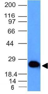 Western blot analysis of human brain lysate using Anti-PGP9.5 Antibody [UCHL1/841]