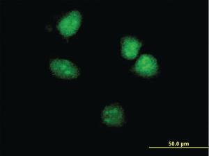 Anti-HOXA5 Mouse Monoclonal Antibody [clone: 2C9]