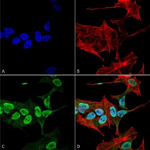 Immunocytochemistry/Immunofluorescence analysis of human neuroblastoma cell line (SK-N-BE, fixed in 4% formaldehyde for 15 min at room temperature, using Anti-alpha Synuclein Antibody [3C11] (A304959), at 1:100 for 60 minutes at room temperatur