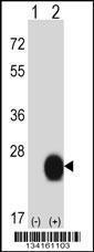 Anti-CSRP2 Rabbit Polyclonal Antibody (FITC (Fluorescein Isothiocyanate))