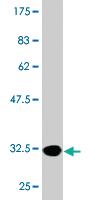 Anti-MTCP1 Mouse Monoclonal Antibody [clone: 1G12]