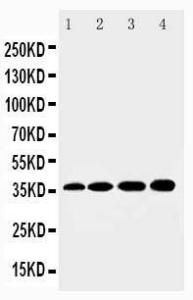 Anti-HSD17B1 Rabbit Polyclonal Antibody