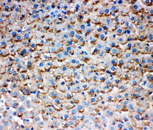 Anti-HSD17B1 Rabbit Polyclonal Antibody