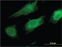 Anti-FAIM2 Mouse Monoclonal Antibody [clone: 2C2]