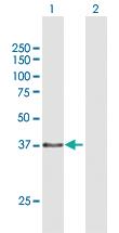 Anti-TEX264 Mouse Polyclonal Antibody