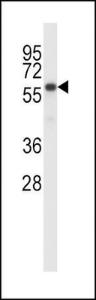 Anti-BIRC2 Rabbit Polyclonal Antibody (APC (Allophycocyanin))