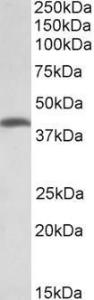 Anti-THNSL2 Antibody (A83064) (2µg/ml) staining of Human Colorectal Cancer lysate (35µg protein in RIPA buffer). Primary incubation was 1 hour. Detected by chemiluminescence.