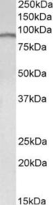 Antibody anti-E2F7 100 µg