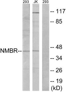 Antibody anti-NMBR 100 µg