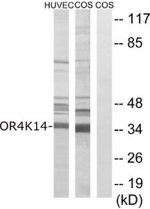 Western blot analysis of lysates from COS7 and HUVEC cells using Anti-OR4K14 Antibody The right hand lane represents a negative control, where the antibody is blocked by the immunising peptide