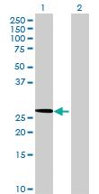 Anti-MRPL15 Mouse Polyclonal Antibody