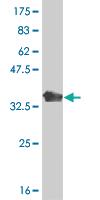 Anti-CD1C Mouse Polyclonal Antibody