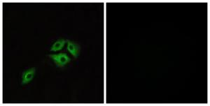 Antibody anti-NMBR 100 µg