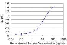 Anti-HOXA5 Mouse Monoclonal Antibody [clone: 2C9]