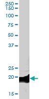 Anti-CNBP Goat Polyclonal Antibody