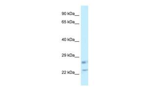 Anti-RASL11B Rabbit Polyclonal Antibody