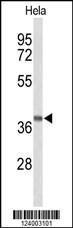 Anti-GPR65 Rabbit Polyclonal Antibody (APC (Allophycocyanin))