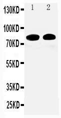 Anti-Calpain 1 Rabbit Polyclonal Antibody