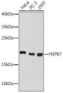 Western blot analysis of extracts of various cell lines, using Anti-HSPB7 Antibody (A307784) at 1:1000 dilution. The secondary Antibody was Goat Anti-Rabbit IgG H&L Antibody (HRP) at 1:10000 dilution. Lysates/proteins were present at 25 µg per lane