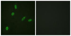 Immunofluorescence analysis of HeLa cells using Anti-ETS1 Antibody. The right hand panel represents a negative control, where the antibody was pre-incubated with the immunising peptide.