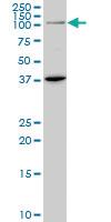 Anti-PRDM1 Mouse Monoclonal Antibody [clone: 1G6]