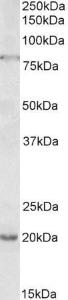 Anti-OAS2 Antibody (A83065) (1 µg/ml) staining of Jurkat lysate (35 µg protein in RIPA buffer). Primary incubation was 1 hour. Detected by chemilu minescence