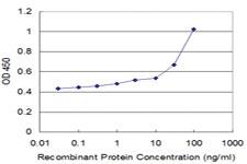 Anti-HOXA6 Mouse Monoclonal Antibody [clone: 3A6]