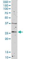 Anti-FGFBP1 Mouse Polyclonal Antibody