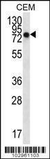 Anti-NEK3 Rabbit Polyclonal Antibody (HRP (Horseradish Peroxidase))