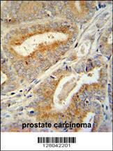 Anti-BCORL1 Rabbit Polyclonal Antibody (FITC (Fluorescein Isothiocyanate))