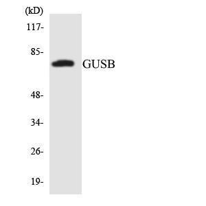 Anti-GUSB antibody