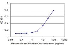 Anti-PRDM1 Mouse Monoclonal Antibody [clone: 1G6]