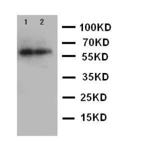 Anti-IL2 Receptor beta Rabbit Polyclonal Antibody