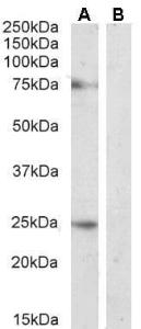 Anti-DLL1 Antibody (A84659) (2µg/ml) staining of Rat Pancreas lysate (A) + Peptide (B) (35µg protein in RIPA buffer). Detected by chemiluminescence.