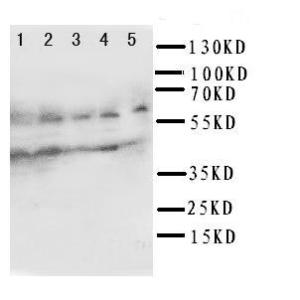 Anti-IL2 Receptor gamma Rabbit Polyclonal Antibody