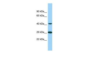 Anti-TTLL1 Rabbit Polyclonal Antibody