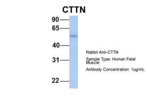 Anti-CTTN Rabbit Polyclonal Antibody