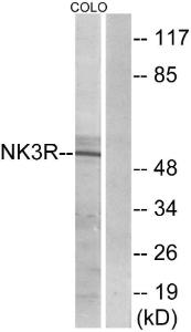 Western blot analysis of lysates from COLO205 cells using Anti-NK3R Antibody The right hand lane represents a negative control, where the antibody is blocked by the immunising peptide