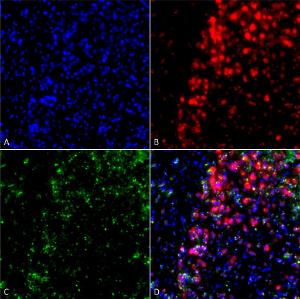 Immunocytochemistry/Immunofluorescence analysis of rat primary hippocampal neurons treated with active alpha synuclein protein aggregate (SPR-322) at 4 µg/ml to induce fibrils, fixed in 4% paraformaldehyde, using Anti-alpha Synuclein Antibody [3F8] (A304961), at 1:200 for 24 hours at 4°C