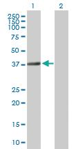 Anti-TEX264 Rabbit Polyclonal Antibody