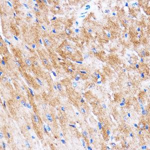 Immunohistochemistry analysis of paraffin-embedded mouse heart using Anti-HSPB7 Antibody (A307784) at a dilution of 1:100 (40X lens). Perform microwave antigen retrieval with 10 mM PBS buffer pH 7.2 before commencing with IHC staining protocol