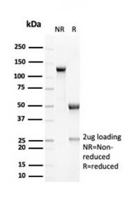 SDS-PAGE analysis of Anti-RCAS1 Antibody [EBAG9/7033R] under non-reduced and reduced conditions; showing intact IgG and intact heavy and light chains, respectively. SDS-PAGE analysis confirms the integrity and purity of the antibody.