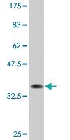 Anti-TNRC6B Mouse Monoclonal Antibody [clone: 3G11]