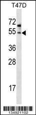 Anti-ZDHHC6 Rabbit Polyclonal Antibody (HRP (Horseradish Peroxidase))