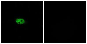 Immunofluorescence analysis of A549 cells using Anti-NK3R Antibody The right hand panel represents a negative control, where the antibody was pre-incubated with the immunising peptide