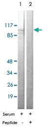 Anti-EEF2 Rabbit Polyclonal Antibody