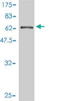 Anti-CTNNA3 Mouse Monoclonal Antibody [clone: 3F4-1B11]