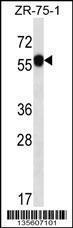 Anti-C6orf211 Rabbit Polyclonal Antibody